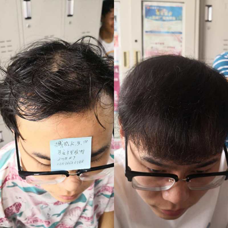 效果案例图片